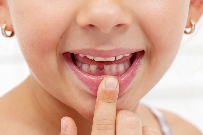 Tooth Fairy