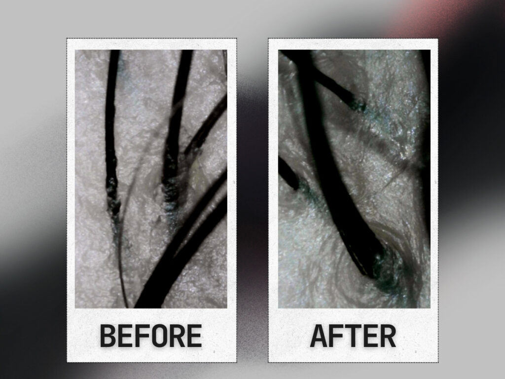 before-and-after - junglecity.com